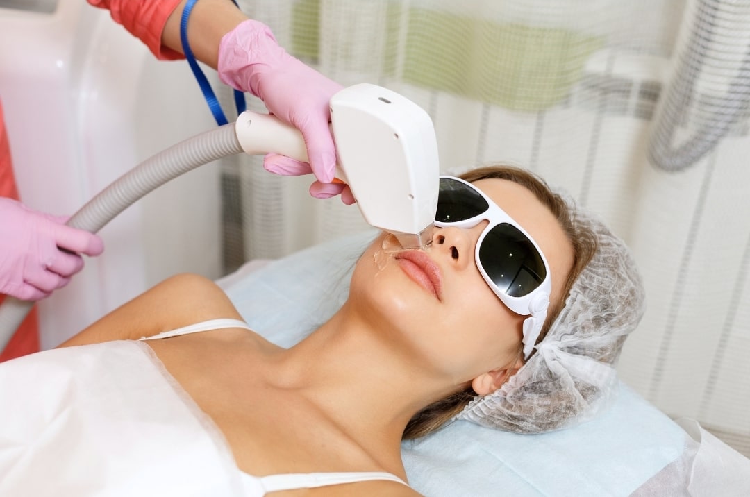 woman receiving laser treatment on face