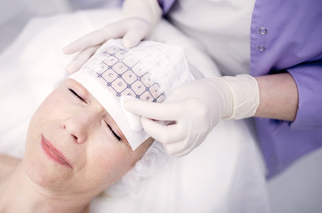 doctor preparing for thermage treatment on woman's forehead