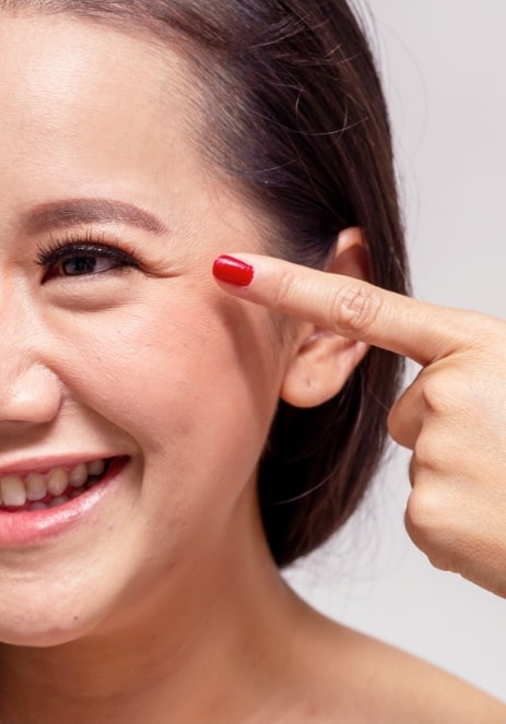 woman pointing to the wrinkles at the corner of her eyes