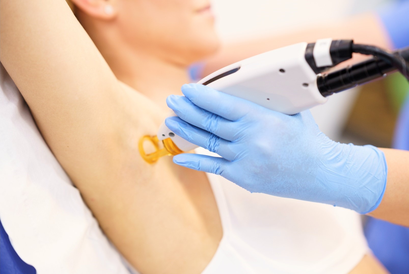 woman undergoing BBL Hair Removal treatment