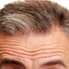 dynamic wrinkles on man's forehead