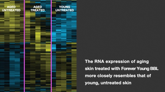 RNA Expression of Aging