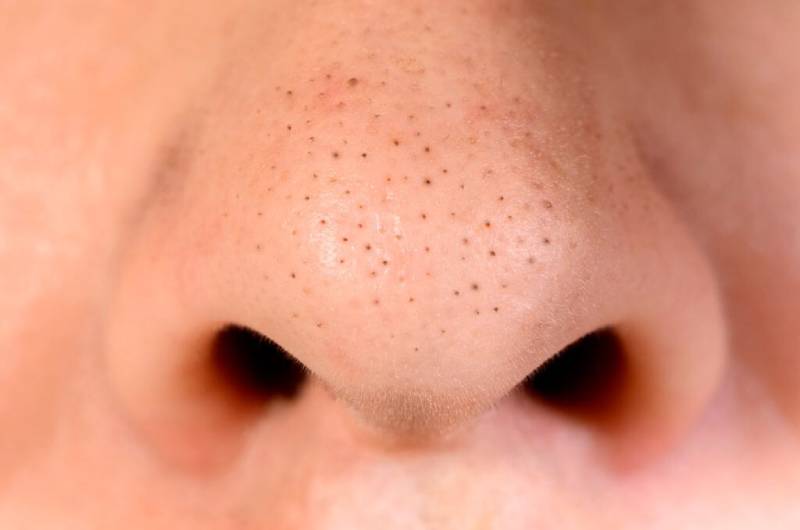 enlarge pores on nose