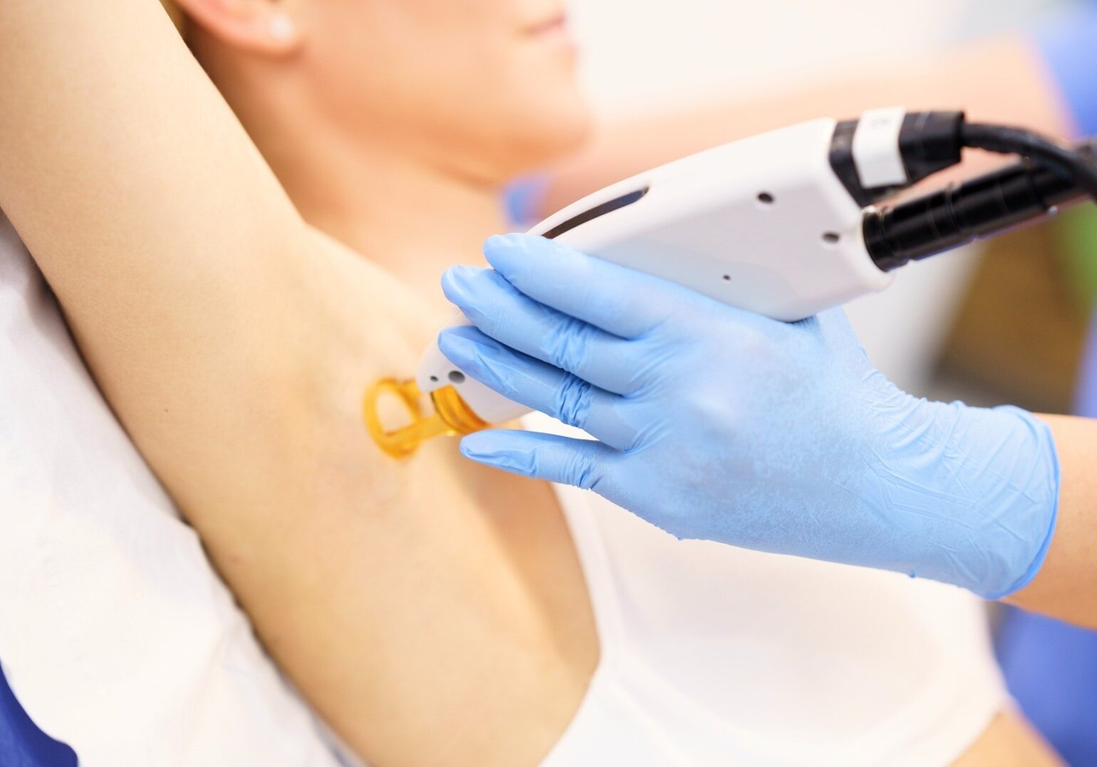 woman undergoing BBL Hair Removal treatment